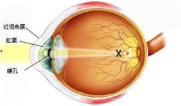 屈光眼睛吃瓜