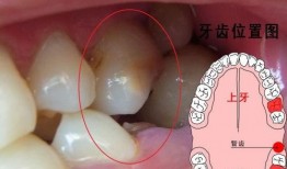 牙龈肿痛吃牛角蜜瓜,天然食疗新选择