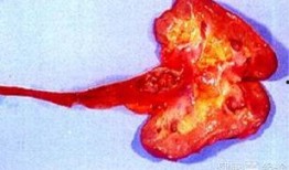 肾癌患者吃瓜,瓜类食材的神奇功效