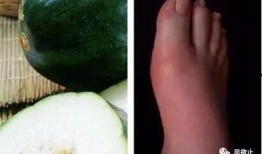 痛风可否吃白瓜,适宜还是禁忌？