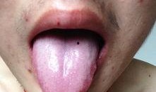 吃瓜突然舌根疼,揭秘夏日饮食健康之谜